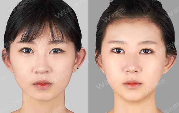 韩国皮肤护理